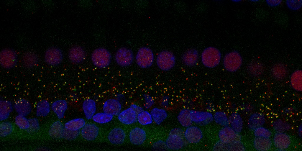 Immunostaining of inner hair cell synapses